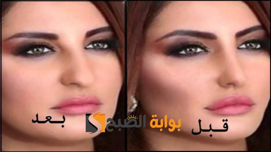 بمعلقة خميرة واحدة أفضل وصفة لتسمين الخدود وتوريدها ونفخ الوجه بدون فيلر وعمليات تجميل