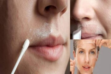 ودعي الألم تماماً … وصفات طبيعية لإزالة شعر الوجه في منتهى السهولة جربيها