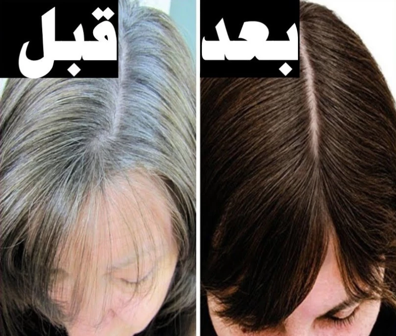 رحلة وداع الشيب.. طرق تغطية الشعر الأبيض باللون الأسود بسهولة بمكونات بسيطة 5 رحلة وداع الشيب.. طرق تغطية الشعر الأبيض باللون الأسود بسهولة بمكونات بسيطة