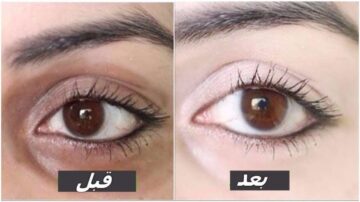 بمكونات طبيعية… اتخلصي من الهالات السوداء في أسرع وقت