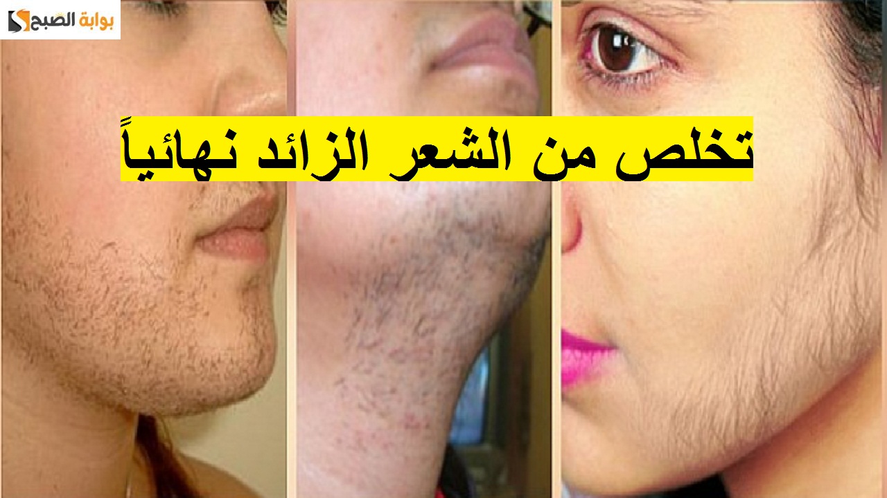 وداعاً للشعر الزائد نهائياً! وصفات طبيعية للتخلص من شعر الوجه والجسم 5 وداعاً للشعر الزائد نهائياً! وصفات طبيعية للتخلص من شعر الوجه والجسم