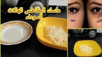من غير ما تدوري كتير.. هاتي بطاطساية واحدة وهتتخلصي من الهالات السوداء بشكل عجيب