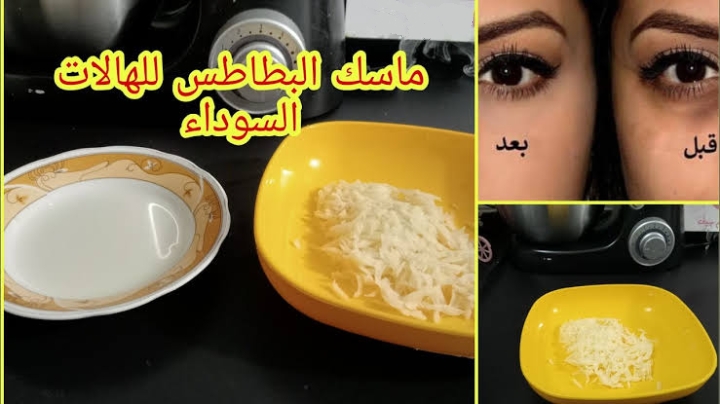 من غير ما تدوري كتير.. هاتي بطاطساية واحدة وهتتخلصي من الهالات السوداء بشكل عجيب