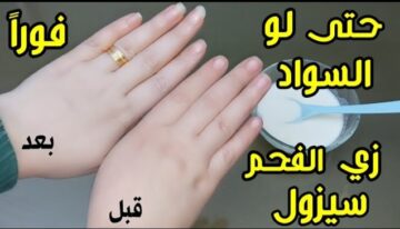 فرق النهار من الليل.. تخلصي من سواد اليدين نهائياً بوصفة سحرية مكوناتها بسيطة