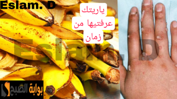 سر متقوليش لعدوك عليه.. حطي قشر الموز في برطمان وشوفي النتيجه.. ياريتك عرفتيها من زمان!!
