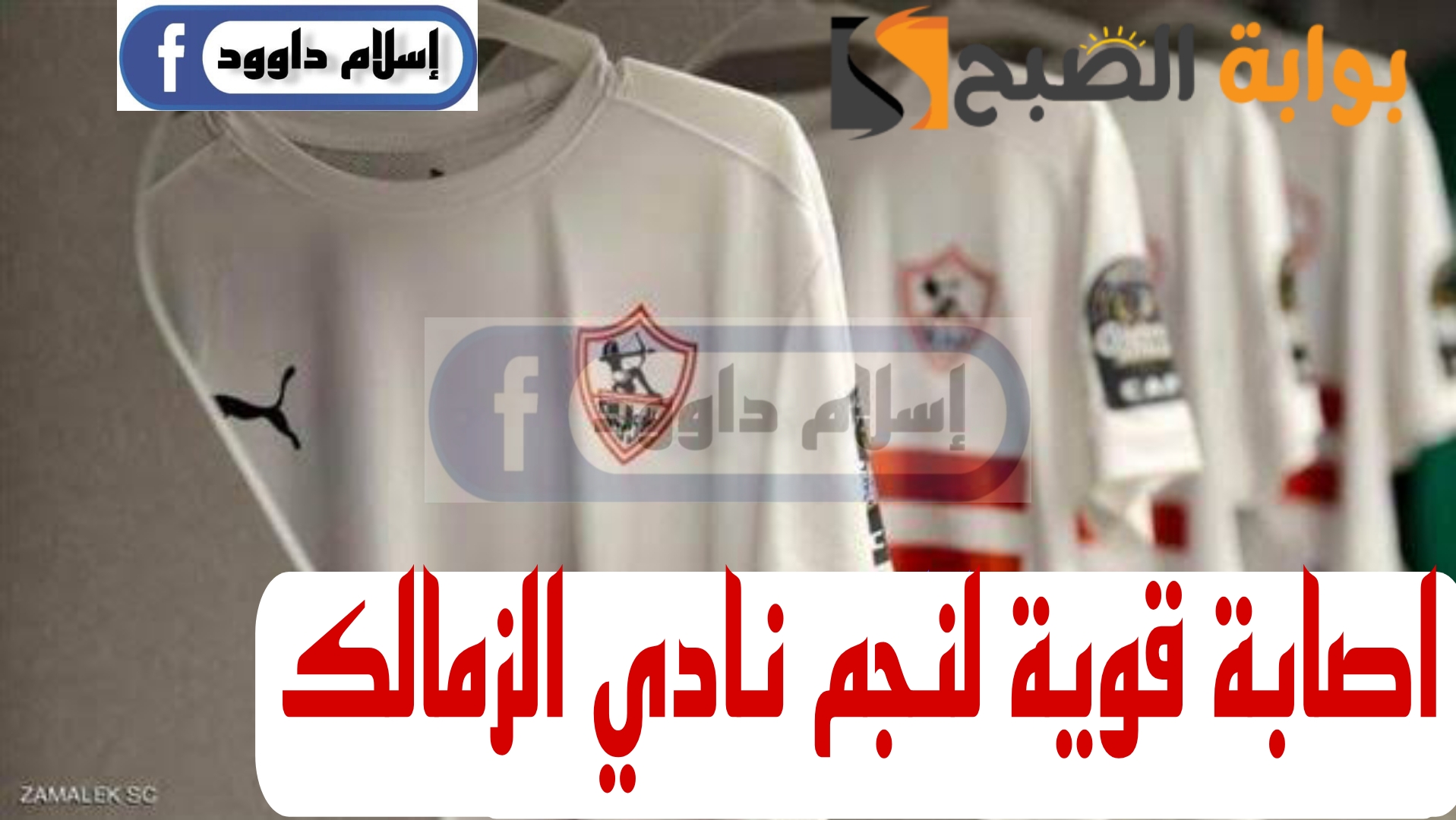 مفاجأة مدوية بشأن اصابة نجم نادي الزمالك
