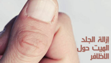 أفضل 3 وصفات طبيعية..لترطيب وإزالة الجلد الميت حول الأظافر من دون أي مواد كيميائية