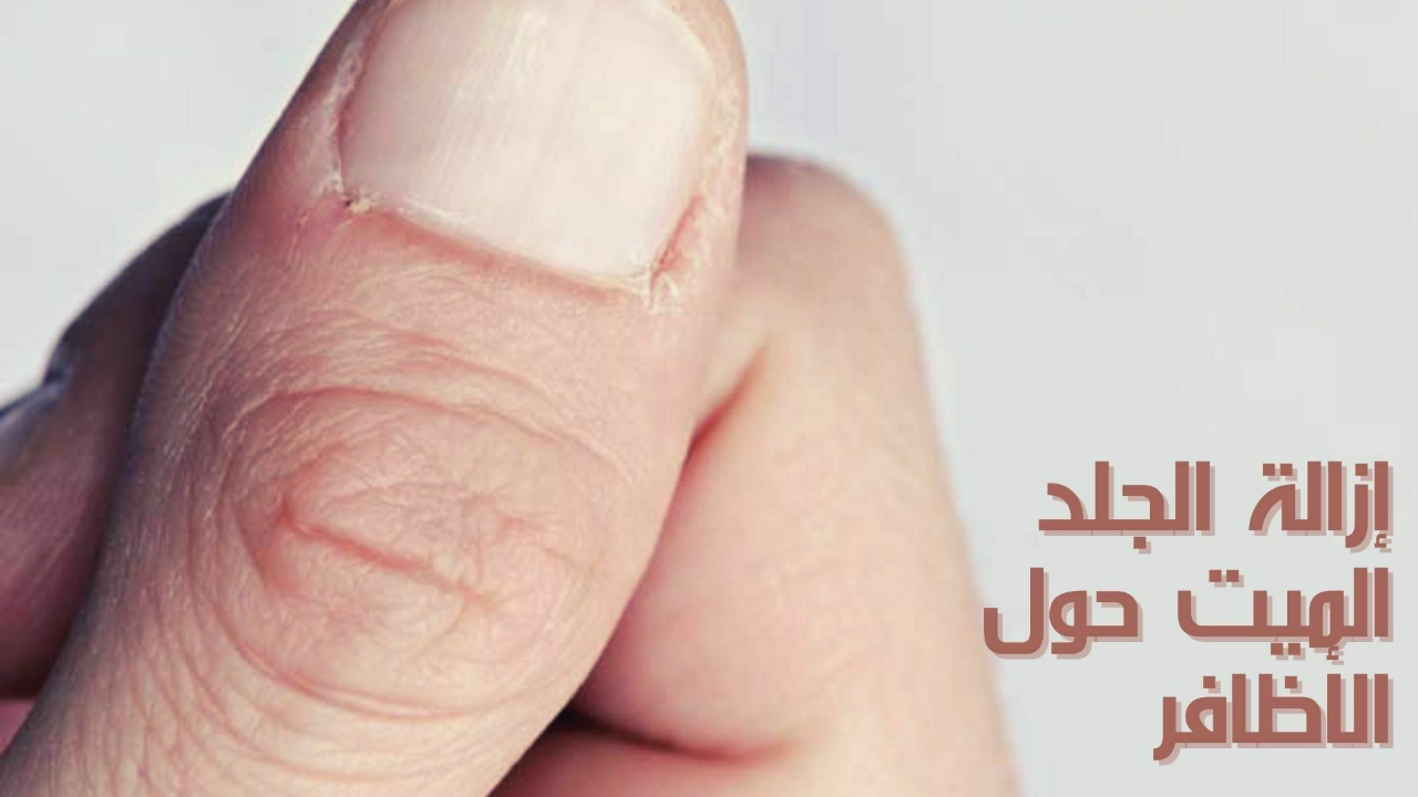 أفضل 3 وصفات طبيعية..لترطيب وإزالة الجلد الميت حول الأظافر من دون أي مواد كيميائية 5 أفضل 3 وصفات طبيعية..لترطيب وإزالة الجلد الميت حول الأظافر من دون أي مواد كيميائية