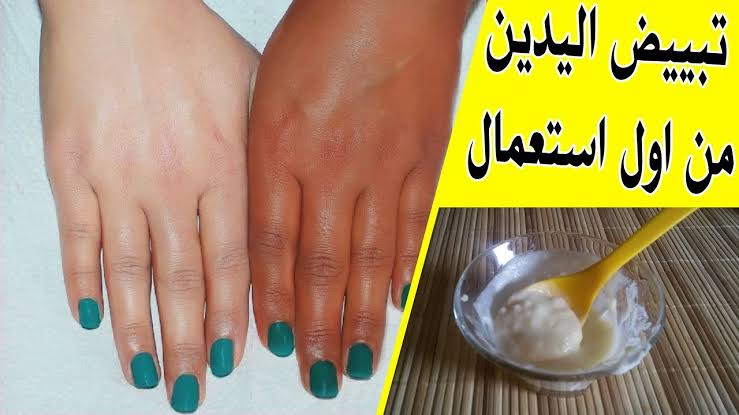هتخلي بشرتك زي الكوريين.. 5 وصفات طبيعية وفعالة لتبييض اليدين والقدمين 6 هتخلي بشرتك زي الكوريين.. 5 وصفات طبيعية وفعالة لتبييض اليدين والقدمين