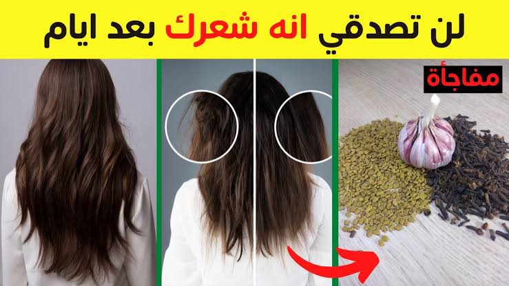 لو شعرك بيقع ماتشليش هم تاني.. وصفات طبيعية تساعد على حماية الشعر من التساقط 