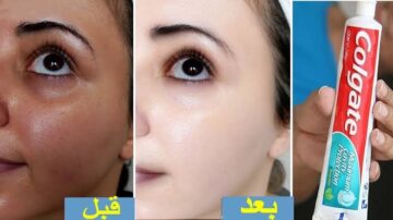 هتحل مشاكلك المستعصية.. استخدمي معجون الاسنان في تفتيح الرقبة والركبتين بتلك الطريقة