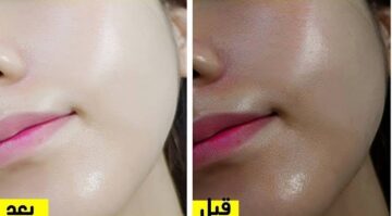 هي دي الوصفات ولا بلاش.. استخدمي الخميرة بالطريقة دي واتفرجي على بشرتك ومش هتصدقي النتيجة