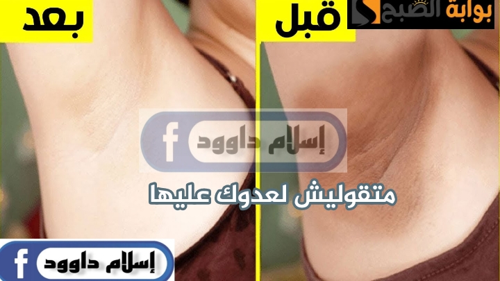 الوصفة السحرية.. طريقة تفتيح المناطق الحساسة بالنشا والليمون جربيها هتبهرك