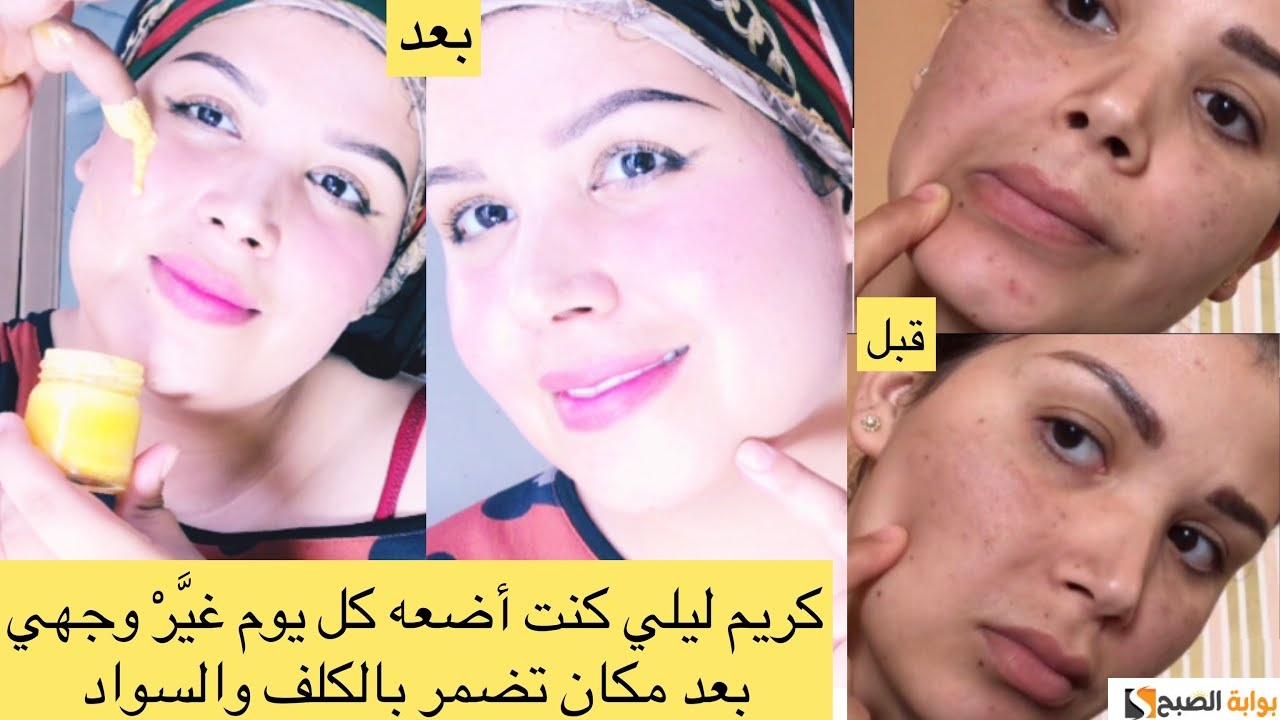 كريم ليلي للتخلص من تجاعيد البشرة والتصبغات 5 كريم ليلي للتخلص من تجاعيد البشرة والتصبغات