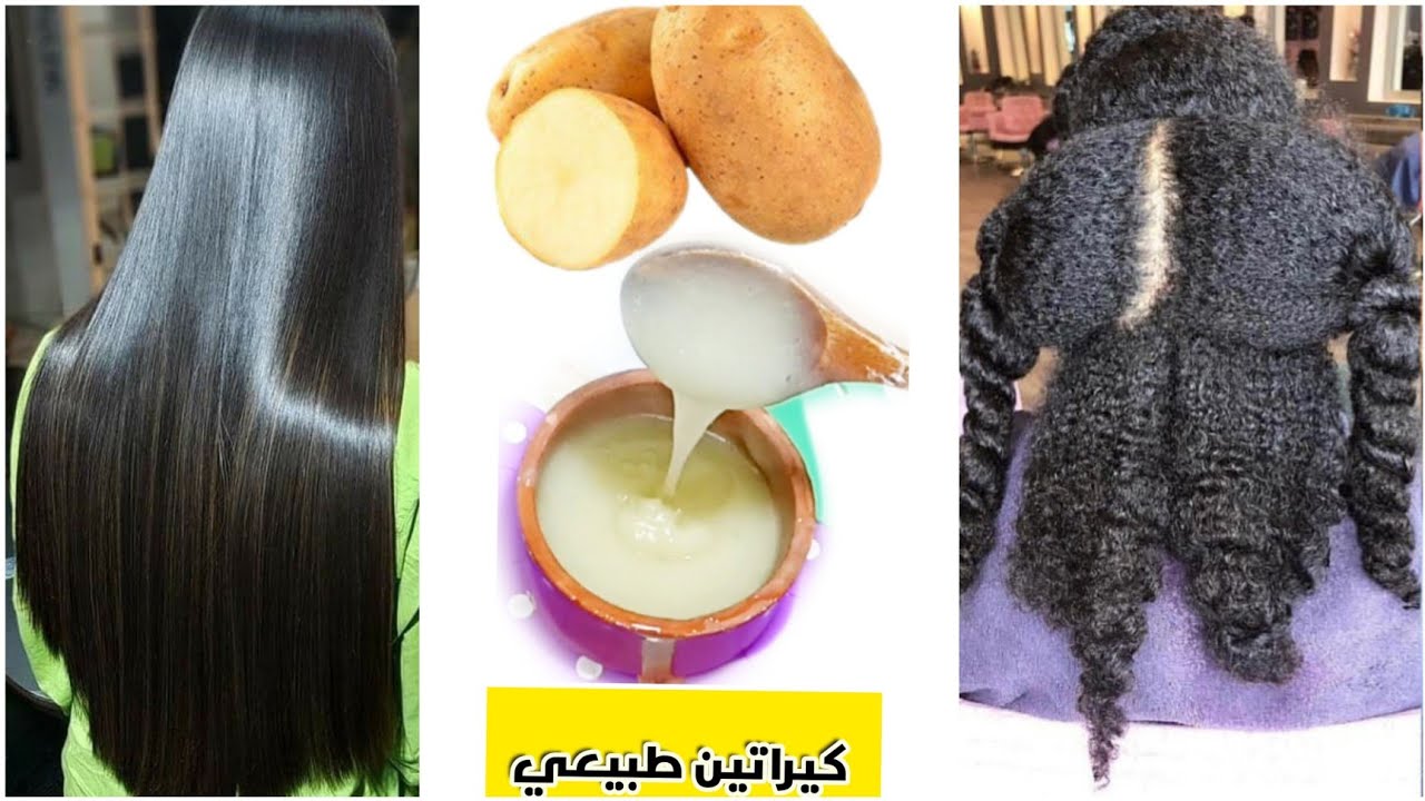 تعرفي على فوائد قشر البطاطس الرهيبه الاولى يا ريتني عرفتها من زمان