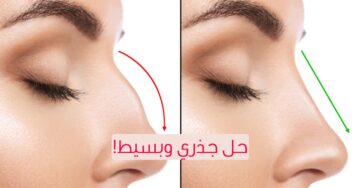 بدون جراحة.. طريقة فعالة للحصول على أنف صغير وجذاب