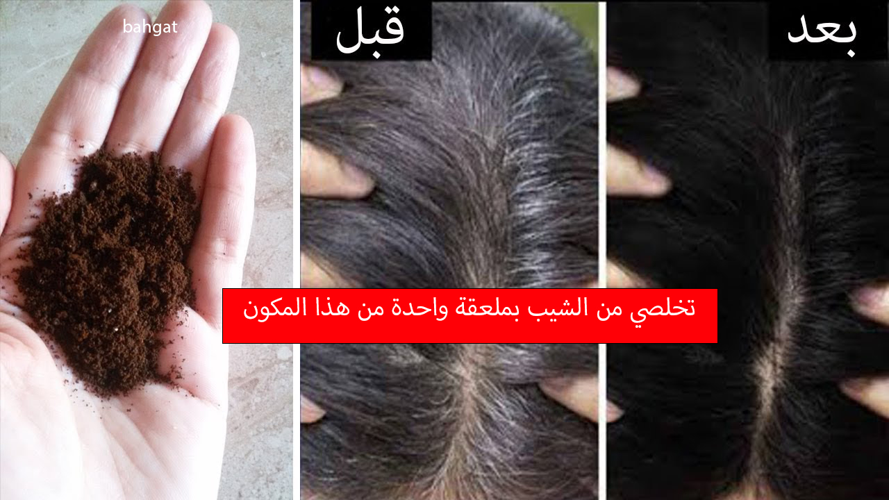 تخلص من الشعر الأبيض بملعقة واحدة من هذا المكون لإخفاء الشيب نهائيا وبسرعة 5 تخلص من الشعر الأبيض بملعقة واحدة من هذا المكون لإخفاء الشيب نهائيا وبسرعة