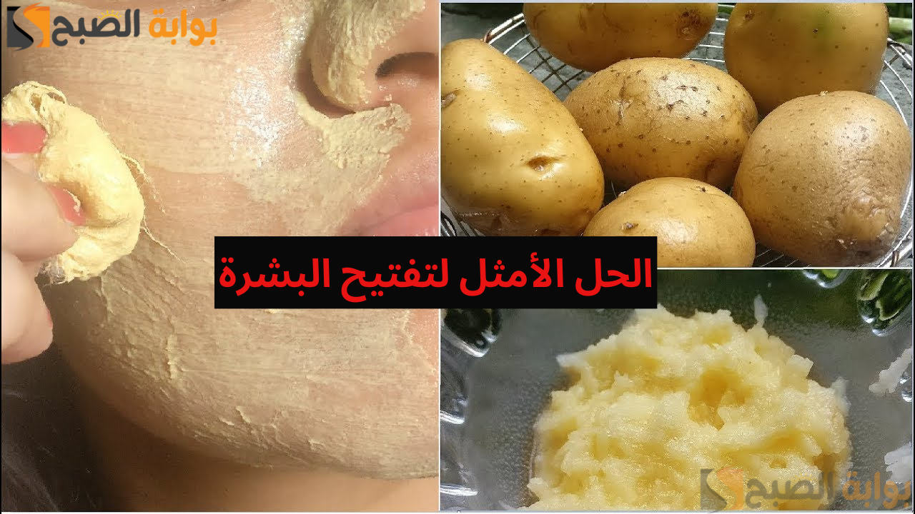 "بشرة صافية 100%" 3 خلطات طبيعية لتفتيح البشرة الدهنية ولا في الخيال 5 “بشرة صافية 100%” 3 خلطات طبيعية لتفتيح البشرة الدهنية ولا في الخيال