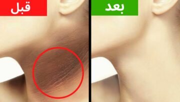 وصفة  لتبييض الرقبة وتنظيف كل السواد اللي موجود مش هتلاقيه تاني