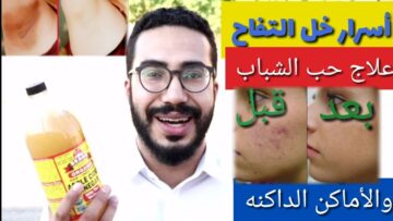 استخدامات خل التفاح للبشرة خليكي زي القمر بمكون طبيعي من منزلك هيغير بشرتك