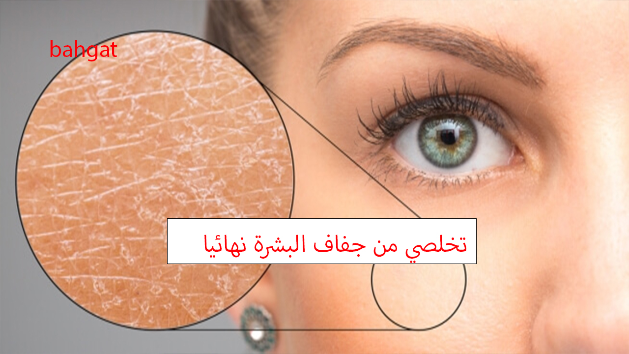 تخلصي من جفاف البشرة باستخدام 3 وصفات طبيعية ومن أول استخدام 5 تخلصي من جفاف البشرة باستخدام 3 وصفات طبيعية ومن أول استخدام