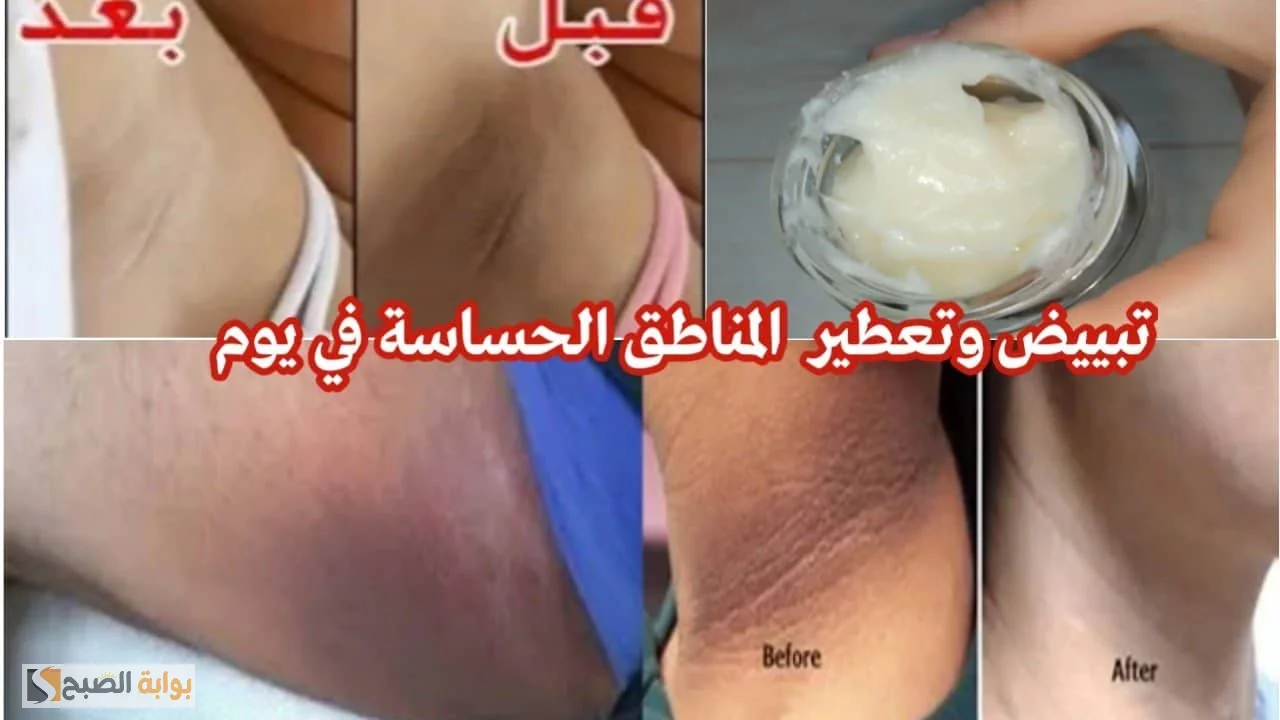 طريقة عمل دلكة الليمون مع الخل لتفتيح الجسم وإزالة الاسمرار من المناطق الحساسة “هتنوري زي الشمعة يوم زفافك”