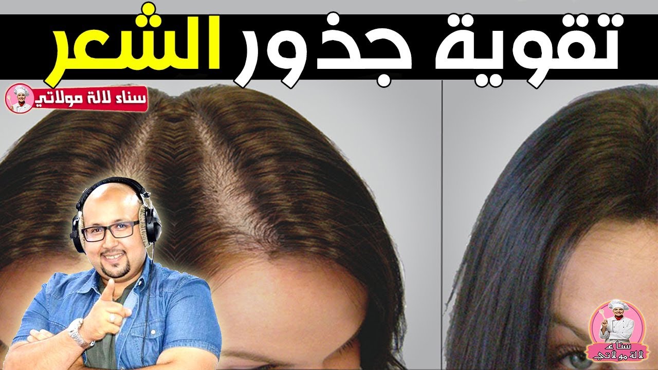 جربيها الآن.. 3 وصفات فعالة لعلاج ضعف جذور الشعر هتخلي شعرك قوي وبيلمع