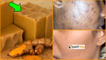 هتنور بشرتك.. طريقة عمل صابونة الكركم السحرية لتبييض البشرة السمراء بياض الثلج حتي لو فحمة في ثواني هتبقي بيضاء زي القشطة