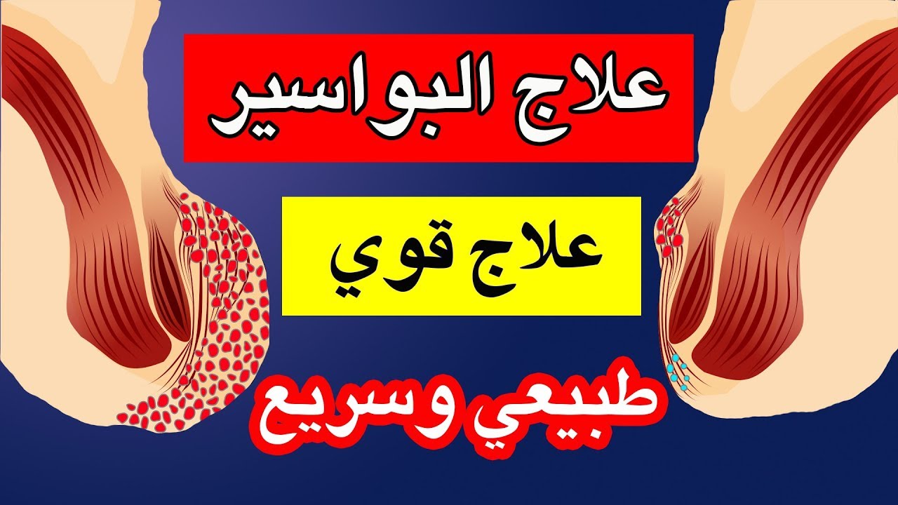 وصفة صينية شهيرة لعلاج البواسير الداخلية والخارجية نهائيا والنتيجة من أول استعمال