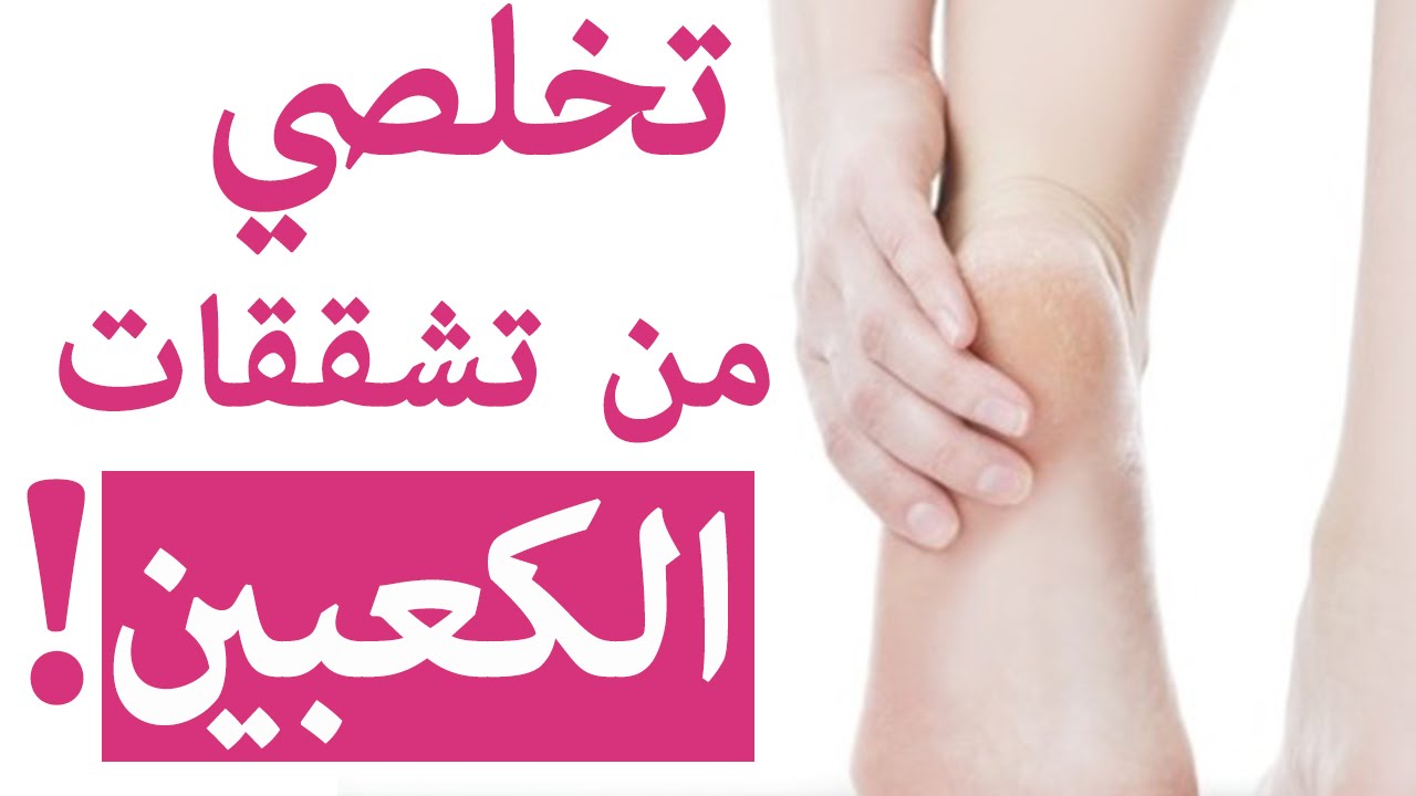علاج تشقق القدمين وجفاف الجلد بأربع مكونات فقط