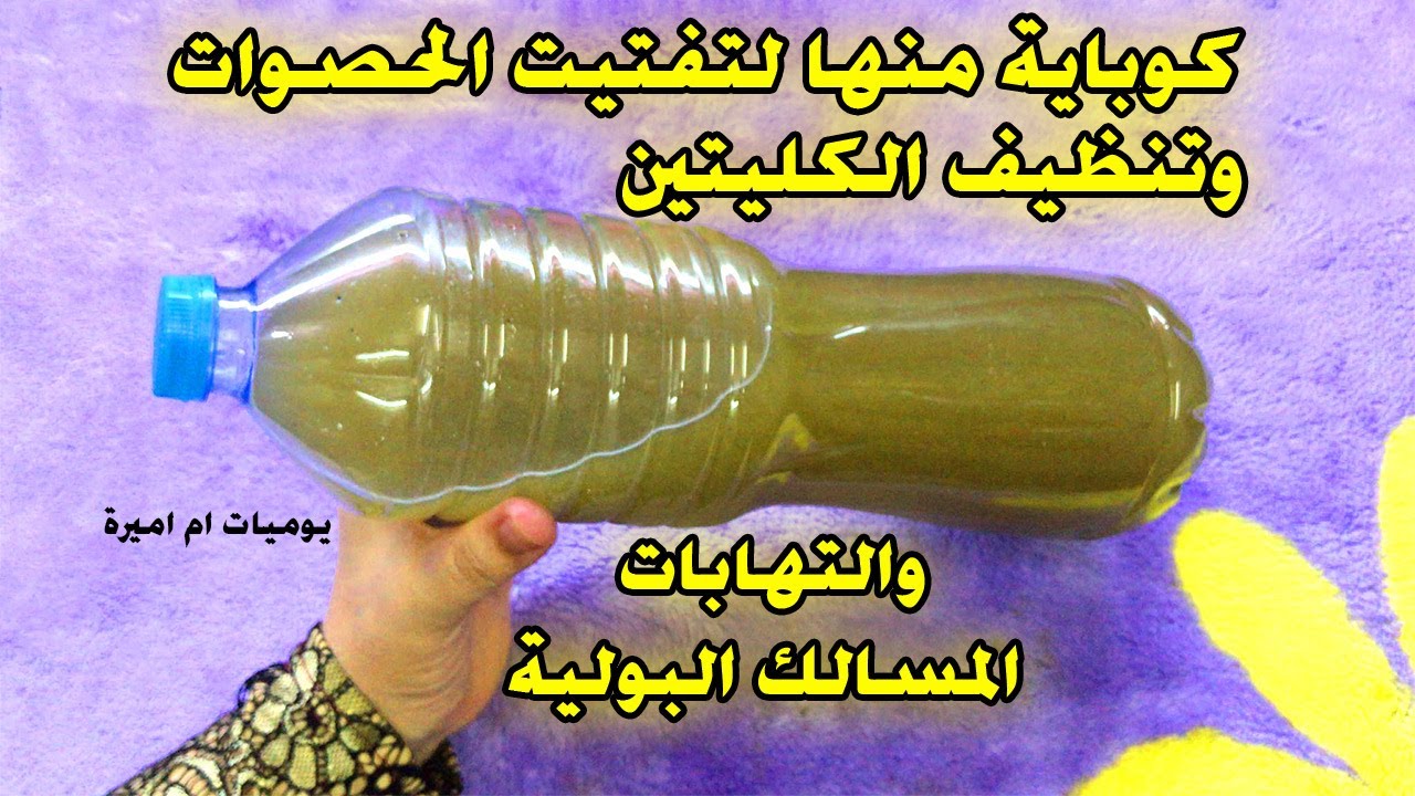 عشبة سحرية هتخلصك من حصوات الكلي في أيام معدودة جربها ومش هتندم