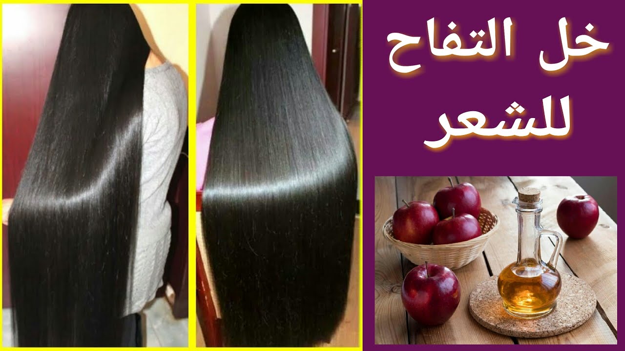 فوائد خل التفاح للعناية بالشعر معلومات هتبهرك مش هتستغني عنه أبدا 5 فوائد خل التفاح للعناية بالشعر معلومات هتبهرك مش هتستغني عنه أبدا