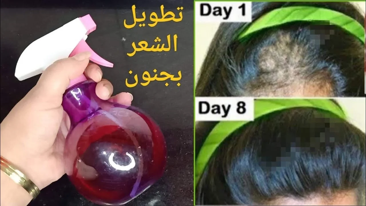 تعالي قبل العيد.. عشبة تطويل الشعر بسرعة مش هتصدقي النتيجة 5 تعالي قبل العيد.. عشبة تطويل الشعر بسرعة مش هتصدقي النتيجة