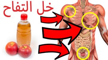 كيفية استخدام خل التفاح وأهم خصائصه المعالجة للمعدة والجسم