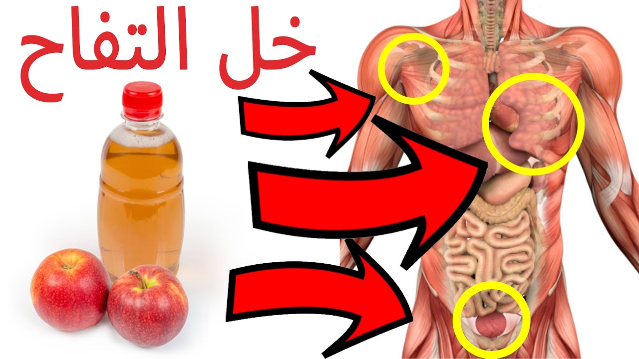 كيفية استخدام خل التفاح وأهم خصائصه المعالجة للمعدة والجسم 5 كيفية استخدام خل التفاح وأهم خصائصه المعالجة للمعدة والجسم