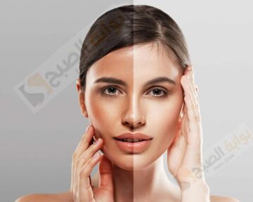ما هو المنتج الذي يبيض الوجه في اسرع وقت وبطريقة امنه دون أضرار