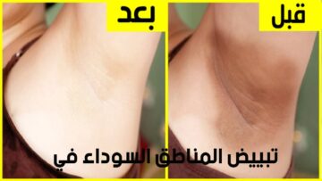 “محدش هيقولك عليها غيري”.. وصفة سحرية لتفتيح منطقة الإبطين بطريقة طبيعية من المنزل ونتيجة مذهلة