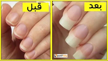 وصفة ممتازة لتطويل الأظافر وتقويتها من مكونات طبيعيه إيدك هتبقى زي ملكات الجمال