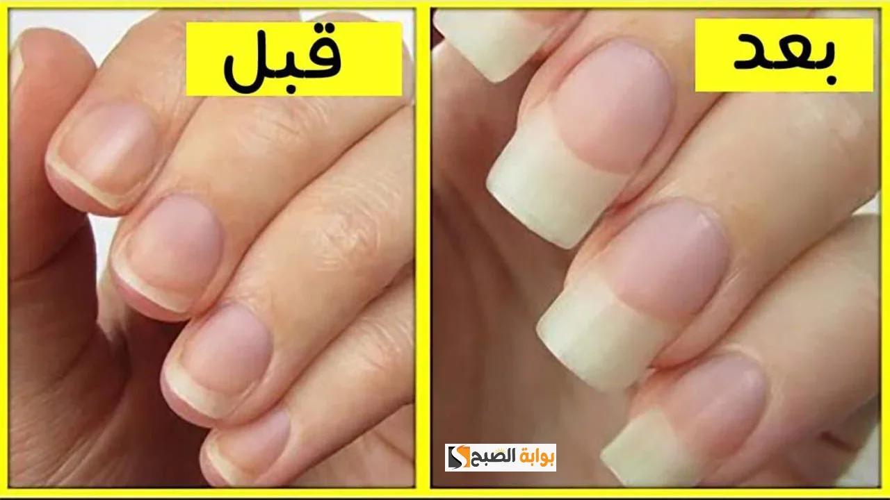 وصفة ممتازة لتطويل الأظافر وتقويتها من مكونات طبيعيه إيدك هتبقى زي ملكات الجمال 5 وصفة ممتازة لتطويل الأظافر وتقويتها من مكونات طبيعيه إيدك هتبقى زي ملكات الجمال