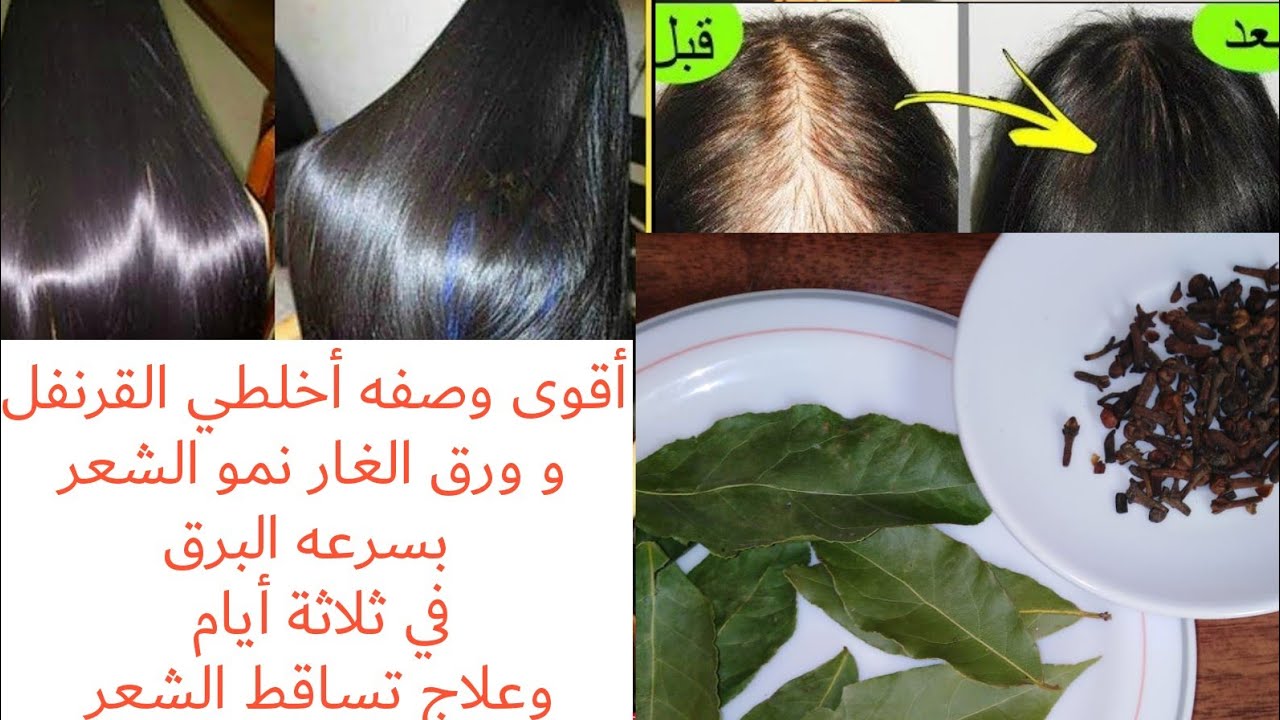 هترجعي بنت العشرين..وصفة ورق الغار مع القرنفل هتخليكى ملكة جمال وهتغير حياتك 180 درجة هتندمي انك معرفتهاش من زمان 5 هترجعي بنت العشرين..وصفة ورق الغار مع القرنفل هتخليكى ملكة جمال وهتغير حياتك 180 درجة هتندمي انك معرفتهاش من زمان