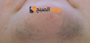 وصفة فعالة لإزالة الشعر الزائد من جذوره دون ألم حل نهائي “للعانة وشعر الوجه والجسم بأكمله”