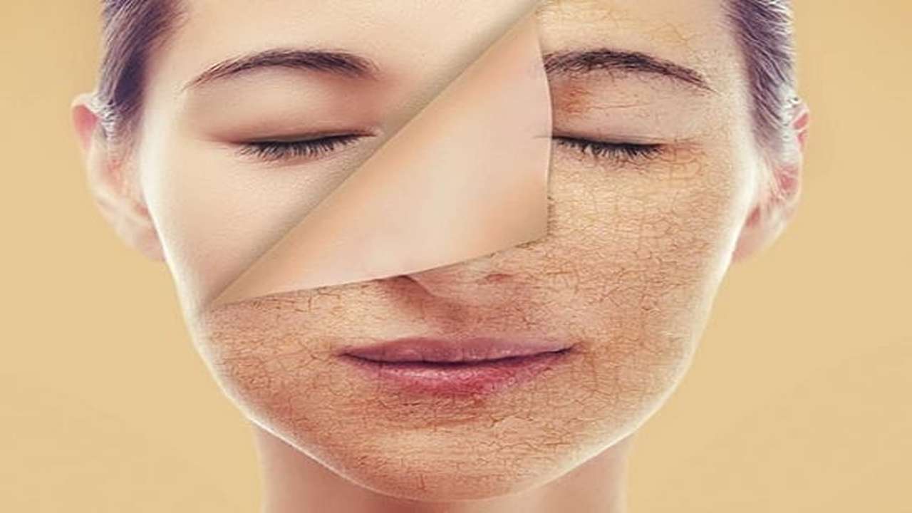 اصنعي مقشر طبيعي للتخلص من تصبغات البشرة 5 اصنعي مقشر طبيعي للتخلص من تصبغات البشرة