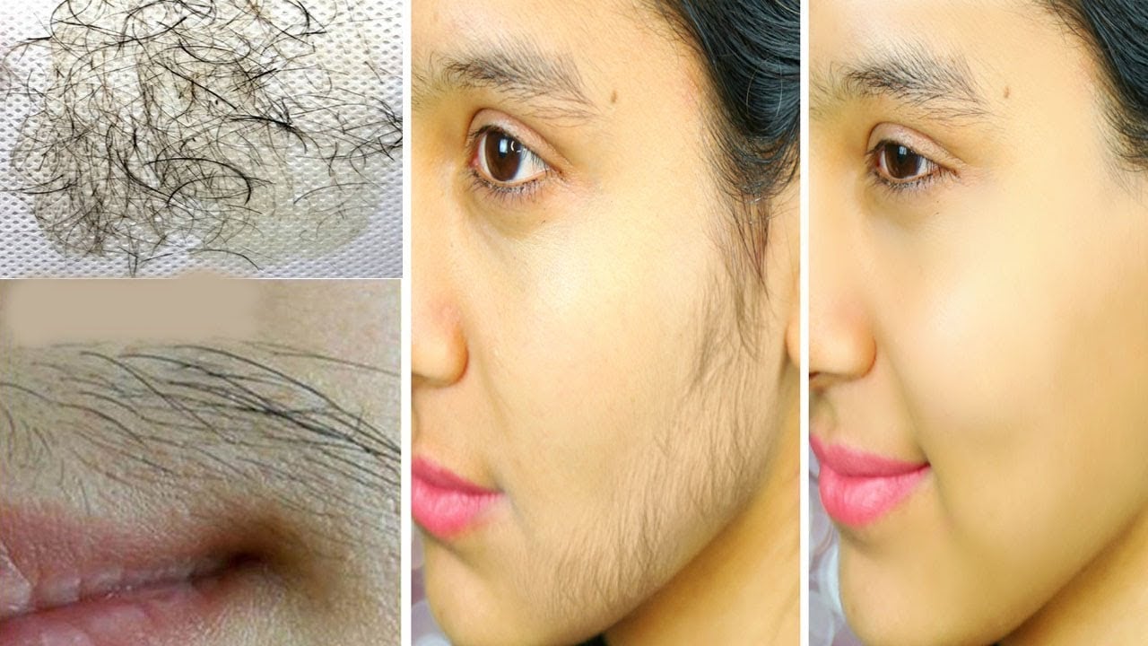 وصفة جبارة لإزالة الشعر الزائد نهائيا من الجذور وبدون أي الم في دقائق معدودة 5 وصفة جبارة لإزالة الشعر الزائد نهائيا من الجذور وبدون أي الم في دقائق معدودة