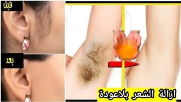 أقوى من الليزر.. إزالة شعر الجسم كلة من الجذور وتقليل النمو بخلطات طبيعية سحريه جربيها في المنزل