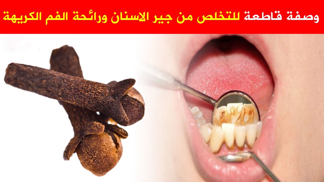 أربع وصفات طبيعية للتخلص من رائحة الفم الكريهة والحصول على نفس منعش