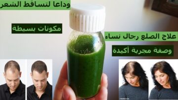لن تستغني عنها ابدا.. وصفة طبيعية لعلاج تساقط الشعر!!