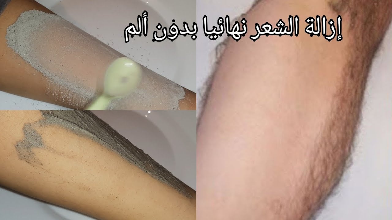 اقوي من الليزر والسويت.. خلطة رماد الفحم الجبارة لإزالة شعر الوجه والجسم كله من الجذور بدون الم نهائي وتبييض المناطق الداكنة