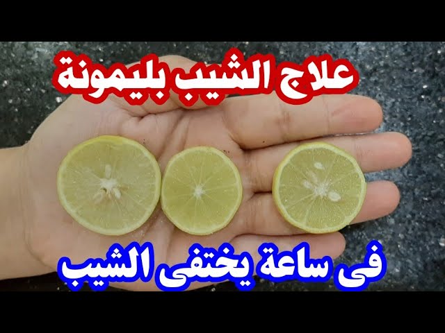 “وداعاً للشيب إلى الأبد” وصفة التخلص من الشعر الأبيض بالليمون في المنزل بمواد طبيعة لا تضر شعرك