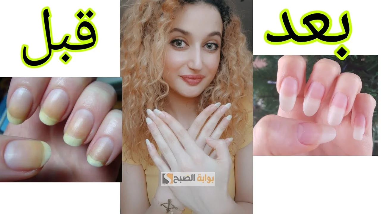 هترجع بتبرق.. طرق طبيعية لتفتيح الأظافر "تخلصى من اللون الأصفر بخطوات بسيطة" 5 هترجع بتبرق.. طرق طبيعية لتفتيح الأظافر “تخلصى من اللون الأصفر بخطوات بسيطة”