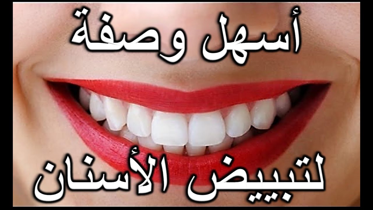خلطة القرنفل الرهيبة لتبييض الأسنان وإزالة الجير والاصفرار المتراكم في دقائق 5 خلطة القرنفل الرهيبة لتبييض الأسنان وإزالة الجير والاصفرار المتراكم في دقائق